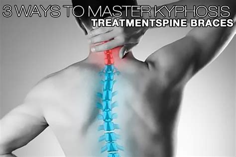 3 Ways To Master KYPHOSIS TREATMENTSPINE BRACES - WorldBrace