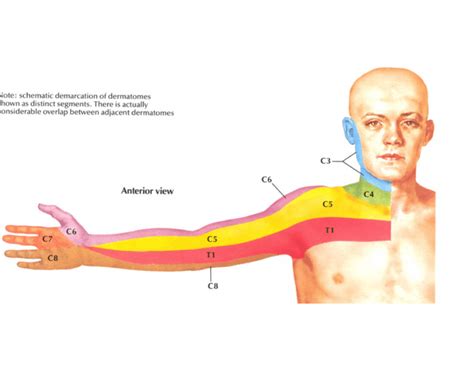 Ue Dermatome Map | Dermatome Map