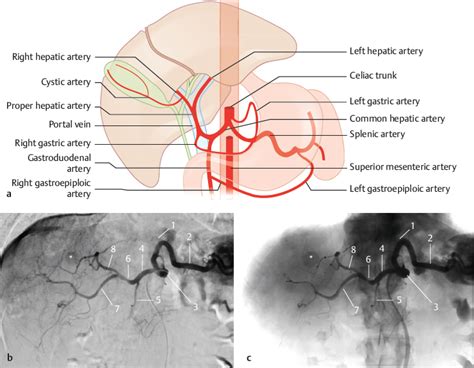 Hepatic Arteries | Radiology Key