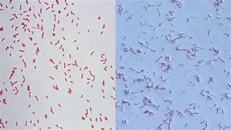 The post Pseudomonas Aeruginosa Under Microscope (Gram Staining ...