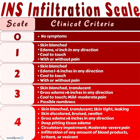 Extravasation vs Infiltration vs Phlebitis: Local Complications of ...