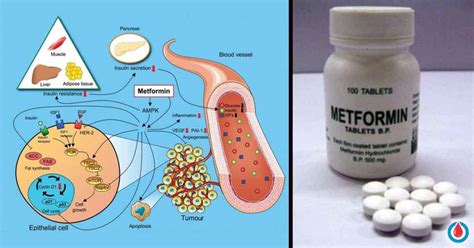 Perks and Side Effects of Taking Metformin 101 | Diabetes Health Page