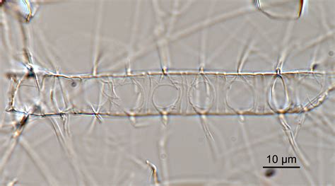 Image Chaetoceros-constrictus-LM4.jpg | Species - Diatoms of North America