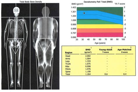 The Scale Lies: Why The DEXA Scan Is Best | Body bones, Bone density, Scan