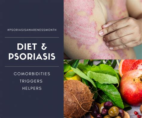 Diet and Psoriasis: Providing Evidence-Based Advice to our Patients ...