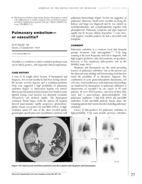 (PDF) Pulmonary embolism--or vasculitis?