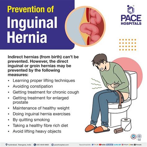 Inguinal Hernia - Signs and Symptoms, Types, Causes, Risk Factors