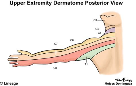 Hand Dermatome Chart - Dermatomes Chart and Map