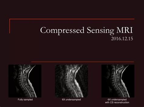 PPT - Compressed Sensing MRI 2016.12.15 PowerPoint Presentation, free ...