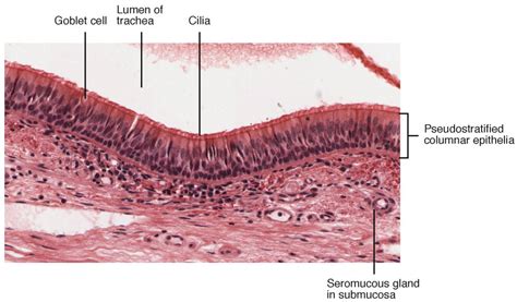 Ciliated Epithelium Labeled