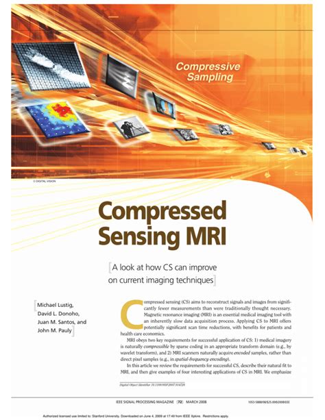 C Compressed Sensing MRI