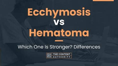 Ecchymosis vs Hematoma: Which One Is Stronger? Differences