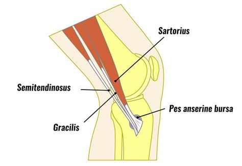 Pes Anserine Bursitis & Tendinopathy - Sportsinjuryclinic.net