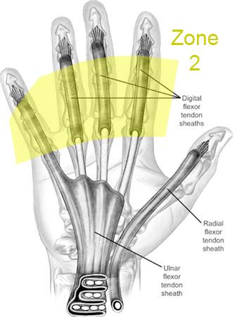 Digital Flexor Tendon Sheath