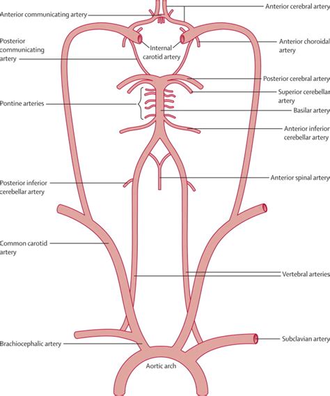 Posterior circulation ischaemic stroke and transient ischaemic attack ...