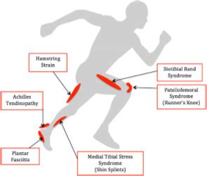 Common running injuries and how to prevent them - Run Strong Run Free