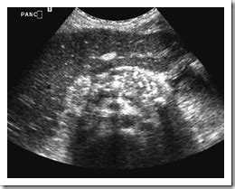 Ultrasound images Chronic pancreatitis - Radiology Imaging