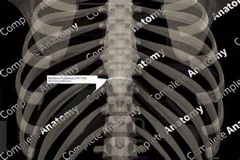 Nucleus Pulposus (T9-T10) | Complete Anatomy