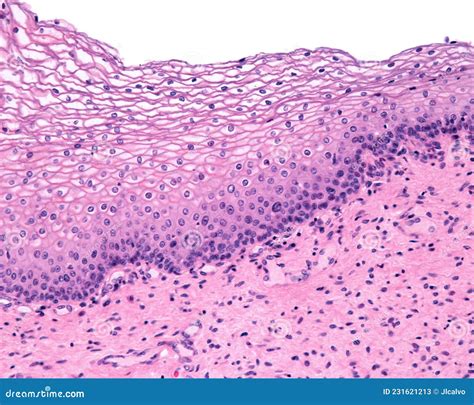 Vaginal Histology Stratified Squamous Epithelium And | The Best Porn ...