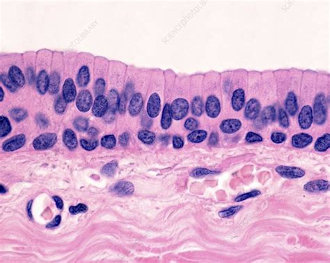 Stratified columnar tissue (image from web) in 2022 | Histology slides ...