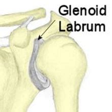 Glenoid labrum tear | Symptoms & Treatment