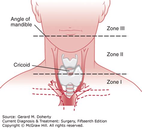 Neck Trauma - GMKA - Global Medical Knowledge Alliance