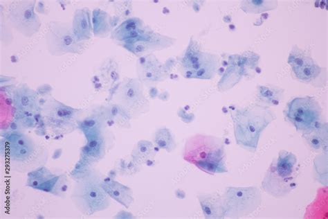 Trichomonas in pap smear on white background view in microscopic ...