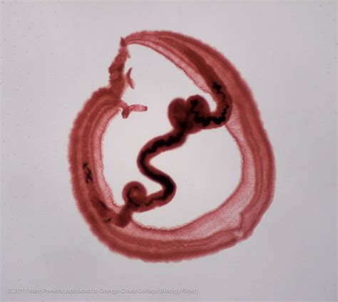 Schistosoma mansoni, male and female | Two Schistosoma manso… | Flickr