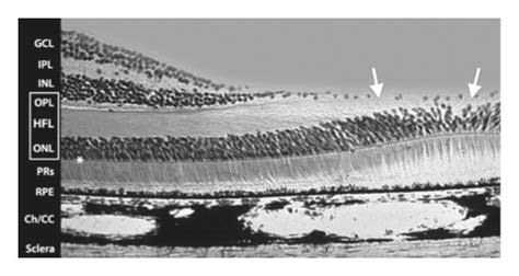 (a) Mammalian foveal histology. Henle’s fiber layer continues in the ...