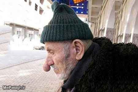 turkish guy with the longest nose in the world - WORLD IN PICTURES