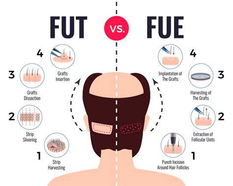 What Is FUE And How It Varies From The Strip Method? - Cyber Hairsure