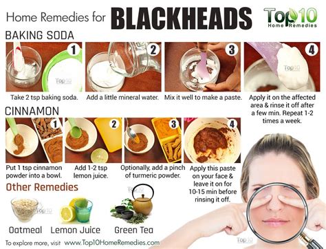 Home Remedies to Get Rid of Blackheads Fast | Top 10 Home Remedies