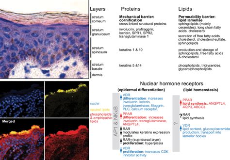 1 Keratinocyte differentiation involves changes in the protein and ...