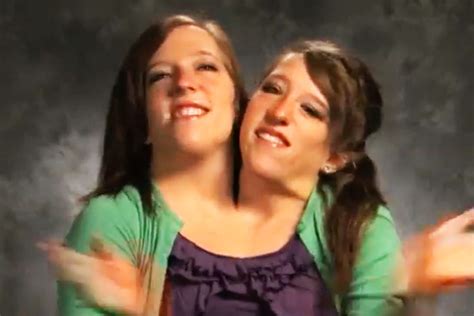 Conjoined Twins Abby and Brittany Hensel Seem to Respond to Marriage ...