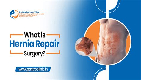 What is Hernia Repair Surgery? | Dr. Kapileshwer Vijay