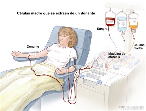 allogeneic stem cell transplant (Patient) - Siteman Cancer Center