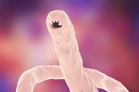 Hookworm infection – causes, side effects and treatments at ...