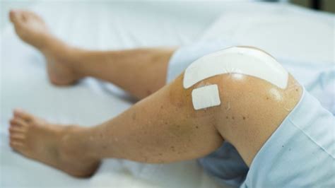 Goodbye knee replacements? A new hope for osteoarthritis treatment ...