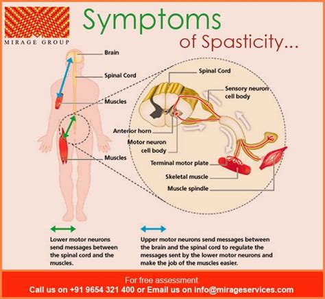 Symptoms of Spasticity ? • Increased muscle tone • Overactive reflexes ...