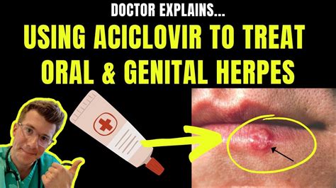 Doctor explains how to use ACICLOVIR (ZOVIRAX) CREAM to treat ORAL ...