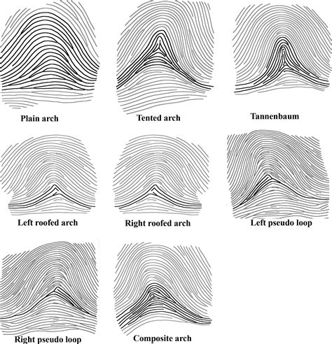 Ulnar Loop Fingerprint