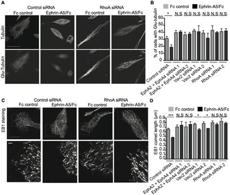 (A) Representative confocal images of total tubulin or stable tubulin ...