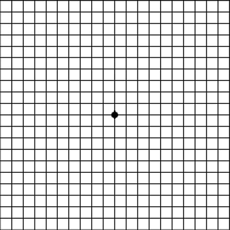 Macular Degeneration Chart Printable