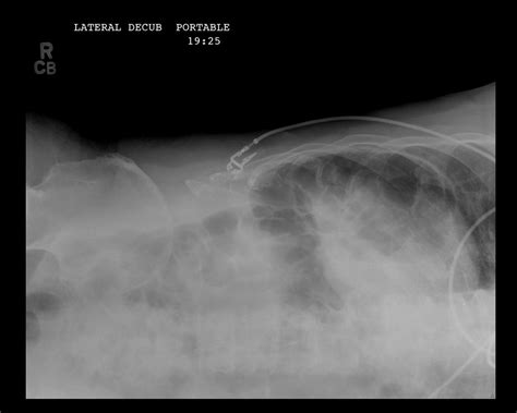 On Call Radiology - common radiology findings on call and in the ...