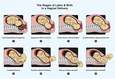 Natural Delivery - Stages, Benefits & Preparation Tips