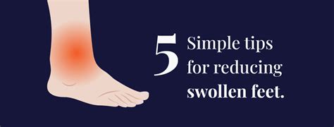 How to reduce swelling in feet | Rela Hospital