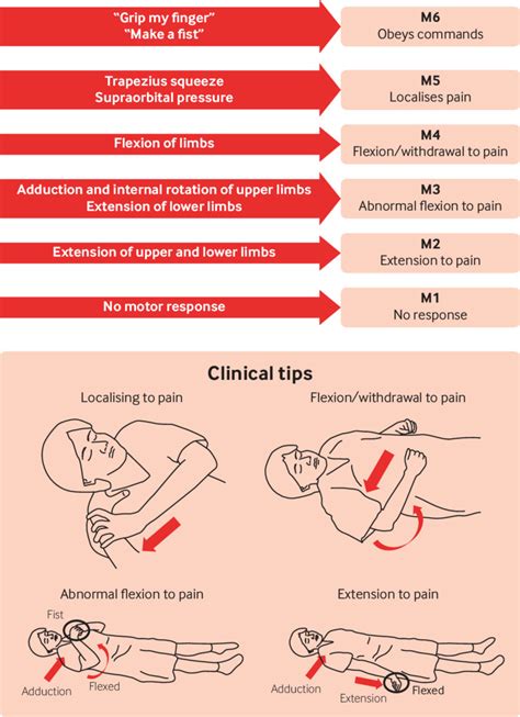 manipolare Diventare matto governo glasgow coma scale nursing Agente ...