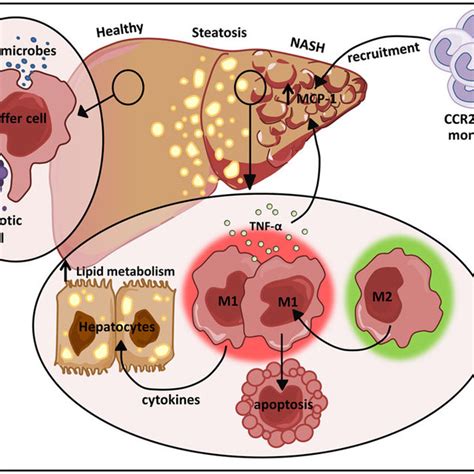 The dual role of M1/M2 Kupffer cells in NAFLD. Kupffer cells play a ...