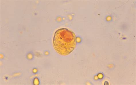 Cyst- Wet mount/ Iodine stain - Department of Parasitology Faculty of ...