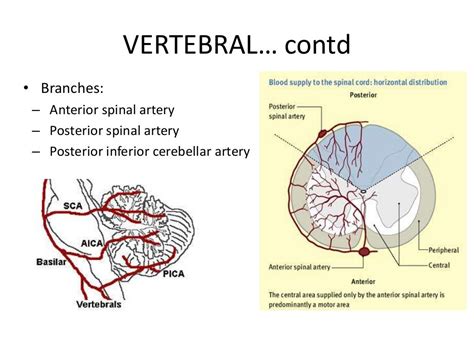 Posterior circulation stroke Syndromes